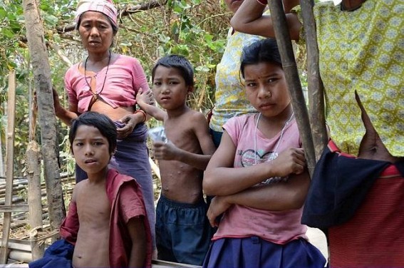Gandacherra under the grip of chicken pox:  Authorities in deep slumber