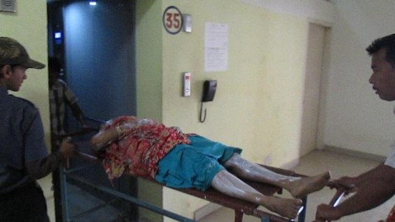Son burns his own mother; Victim's condition very critical with 90% burn injuries