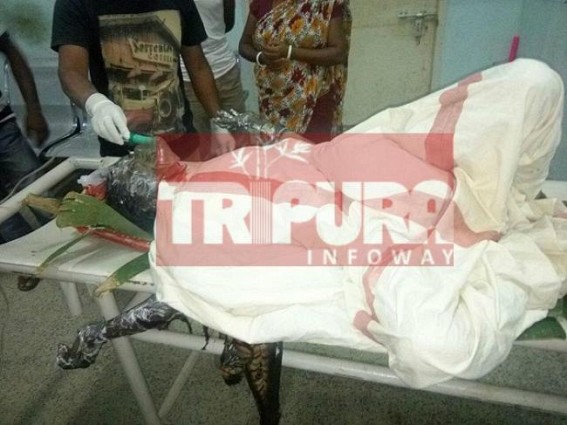 20 years old housewife burnt at Udaipur : No arrest yet  