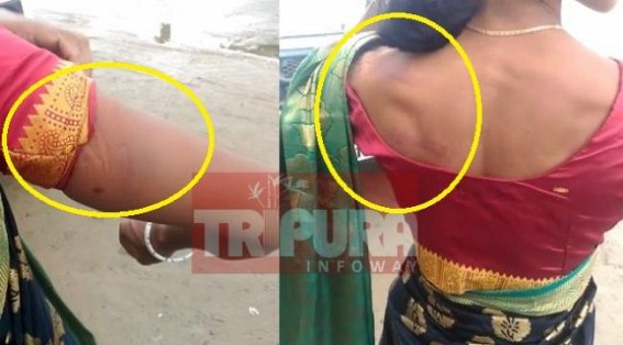 Housewife tortured, beaten brutally for dowry