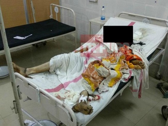 Housewife burnt to death, dowry allegations against In-law's family members 