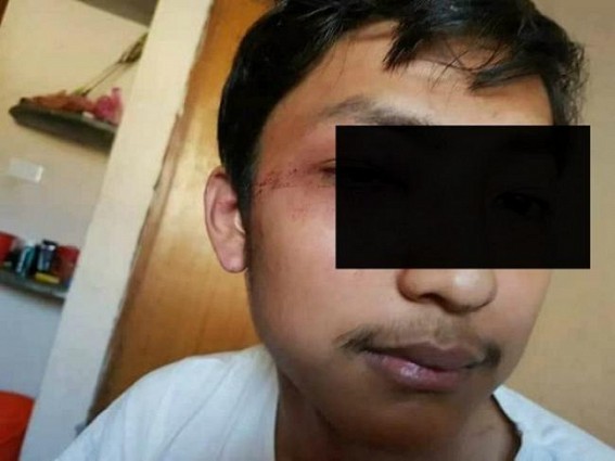 CPI-M alleges ragging inside NIT : student's photo goes viral