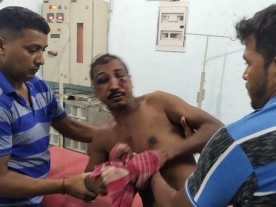 One injured in political attack at Udaipur (Tripura)