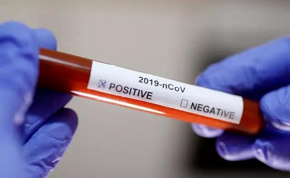 COVID-19 slower than flu but more dangerous: WHO