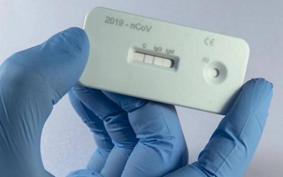 Rapid Anti-Body tests started in Tripura 