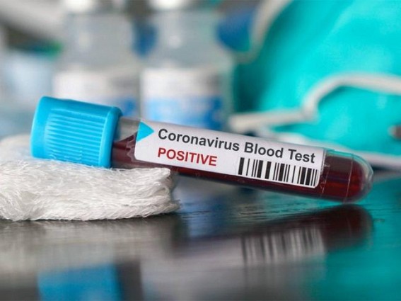 1 death, 26 corona cases raises Karnataka tally to 951