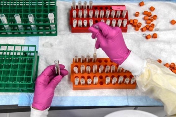 How to decide who should get the Covid-19 vaccine first