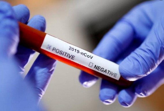 All 17 'high-risk' Tripura people tested negative for COVID-19