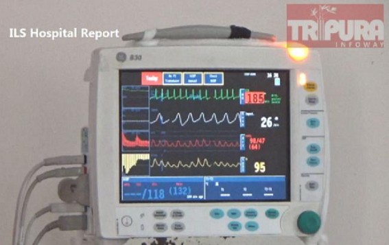 Advocate General's condition critical, in ventilation : Referred to Kolkata 