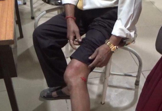 BJP bike gang goons organized deadly attacks on CPI-M workers during an indoor party meeting in Ghoramara area of Ranibazar