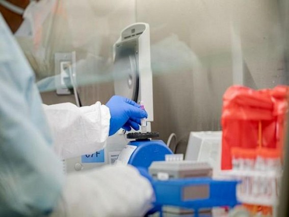 Philippines logs 5,257 new Covid-19 cases, total rises to 1,240,716