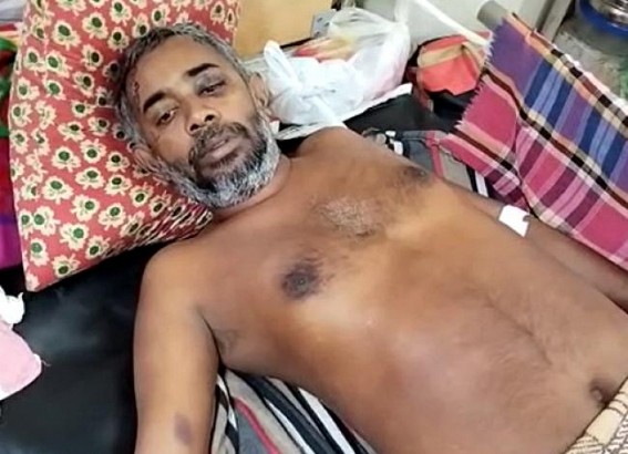 BJP party worker hospitalized, alleged ‘CPI-M beat me up’