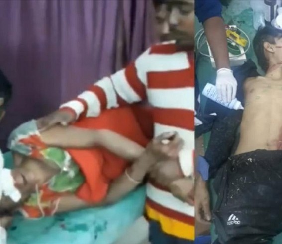 BJP’s Terror under Biplab Deb Continues in Tripura, 2 CPI-M members injured