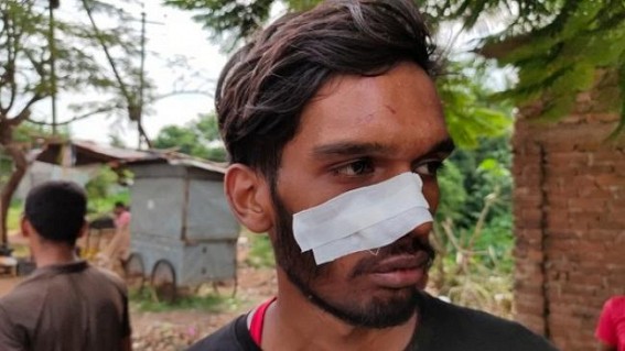 A young man was beaten up by Pistol in Khezurbagan area under NCC PS, accused escaped