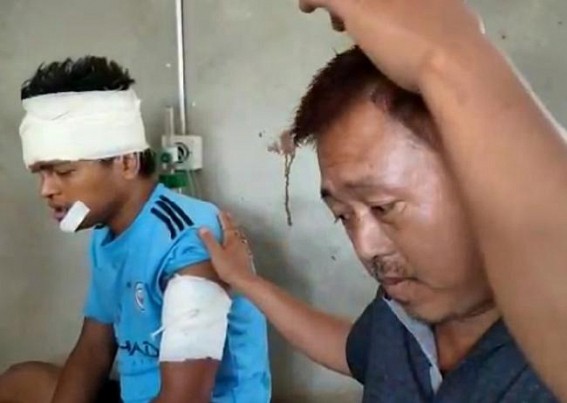 Youth sustained critical injuries after being hit by SP Khowai's escort car