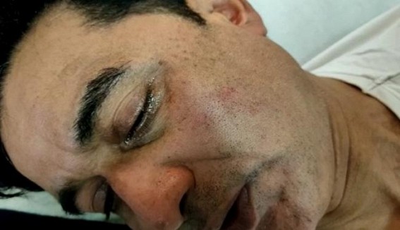 Election Commission Suspended 3 Cops for Jirania Violence