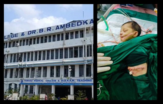TMC’s another success story : 12 days old baby recovered from deadly disease after major operation 