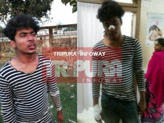 Lawless Tripura : Youth accuses BJP for ghastly attack at Dharmanagar 