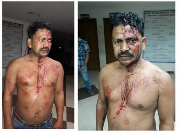 CPI-M supporter beaten, massive violence across Dukli