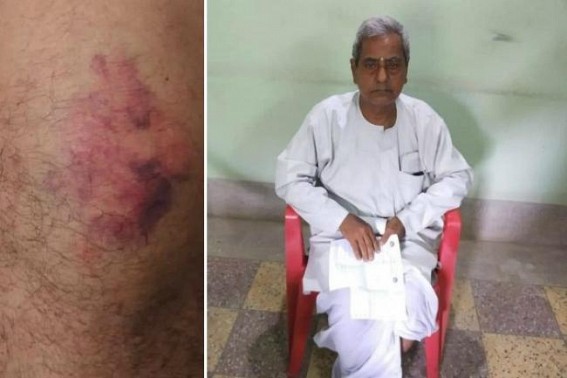 Senior Citizen beaten in Tripura for becoming CPI-M Polling agent, hospitalized