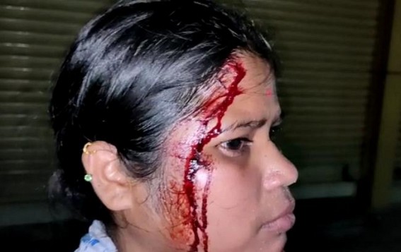 Shame!!! BJP leader mercilessly beaten woman at Nandan Nagar: After 3 times of written complain police did not show up to help her