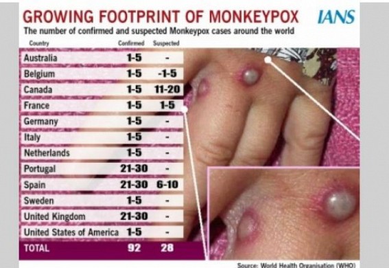 Experts warn of unusual monkeypox outbreak in Aus