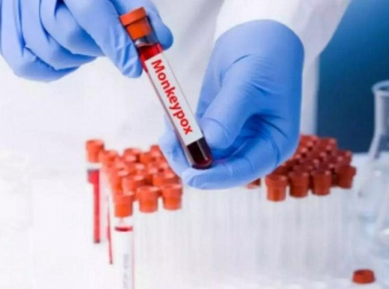 Germany confirms first monkeypox case in a child Germany confirms first monkeypox case in a child