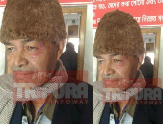 TIWN Editor condemns BJP’s attack on Bhanulal Saha TIWN Editor condemns BJP’s attack on Bhanulal Saha