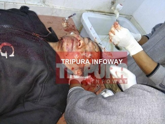 CPI-M's Red Terror begins after Election date's announcement : BJP activist beaten in public rally, left serious at Dharmanagar hospital CPI-M's Red Terror begins after Election date's announcement : BJP activist beaten in public rally, left serious at Dharmanagar hospital