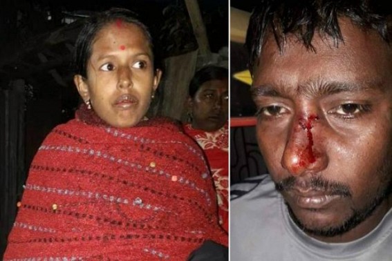 CPI-M activist attacked at Jirania by BJP miscreants CPI-M activist attacked at Jirania by BJP miscreants