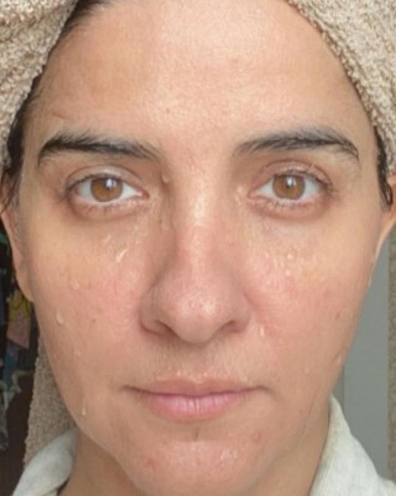 Shruti Seth in extreme close-up, sans make-up Shruti Seth in extreme close-up, sans make-up